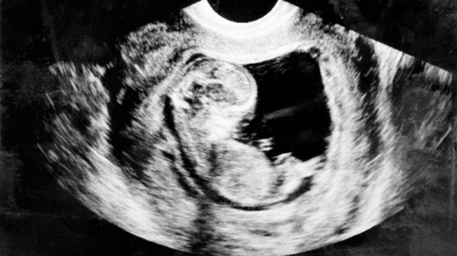Texas aprueba un proyecto de ley para prohibir los abortos y proteger a todos los bebés por nacer
